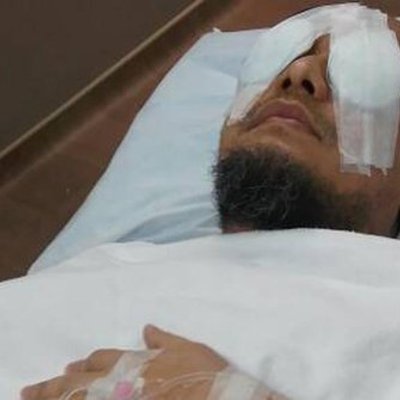 jaringan bagian mata kiri novel diperkirakan sulit pulih jaringan bagian mata kiri novel diperkirakan sulit pulih